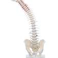 Standard spine with prolapse, pelvis and stand_0