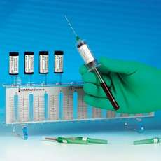 ESR Bloed opvangsysteem vacuümbuizen, Totaal: 2 ml incl. 0,4 ml natriumcitraatoplossing.