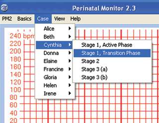 Perinatal Monitor CD ROM with scenario builder